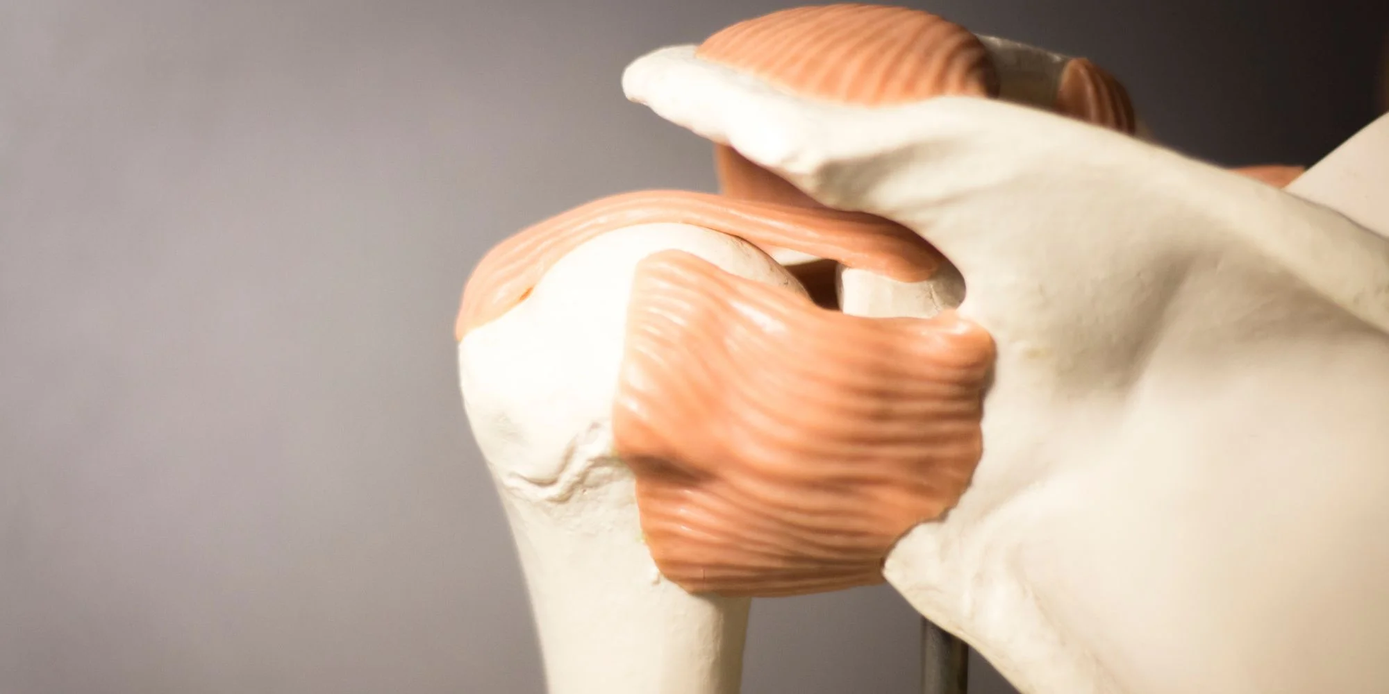 Calcific tendonitis shoulder-Cyprus Orthopaedics