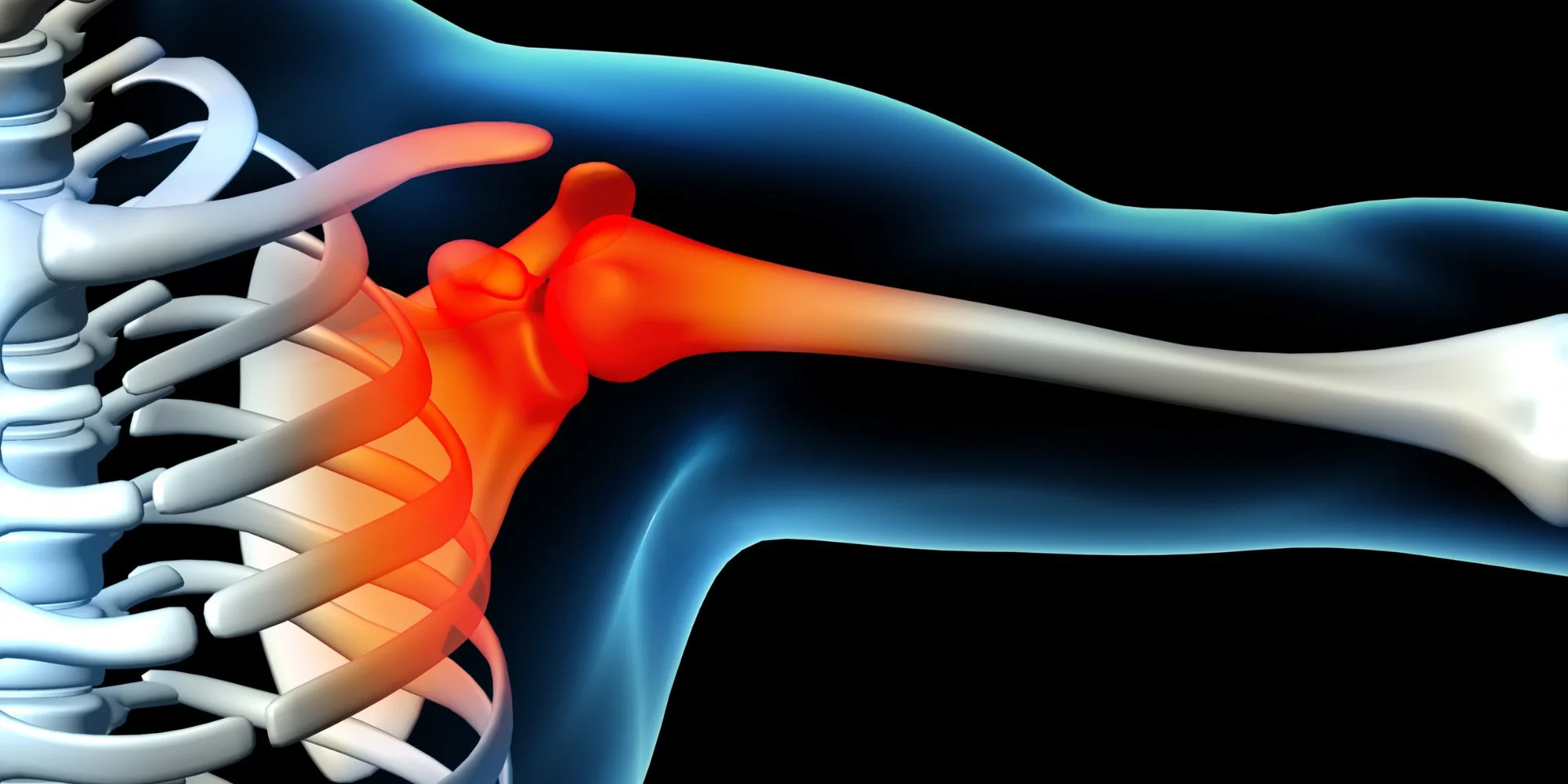 Common Shoulder Conditions-Cyprus Orthopaedics