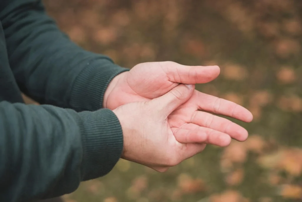 Is it Just a Numb Hand? 5 Signs Your Carpal Tunnel Syndrome is Progressing